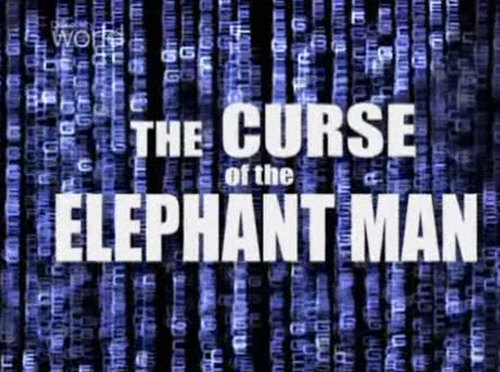 Kl±twa cz³owieka s³onia / Curse of the Elephant Man (2003) PL.TVRip.XviD / Lektor PL Kl±twa cz³owieka s³onia / Curse of the Elephant Man (2003) PL.TVRip.XviD / Lektor PL