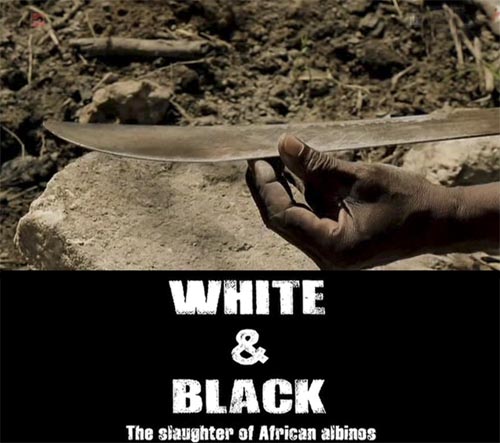 Biali czarni Rzeź afryka?skich albinosów / White and Black (2010) PL.TVRip.XviD / Lektor PL Biali czarni Rzeź afryka?skich albinosów / White and Black (2010) PL.TVRip.XviD / Lektor PL