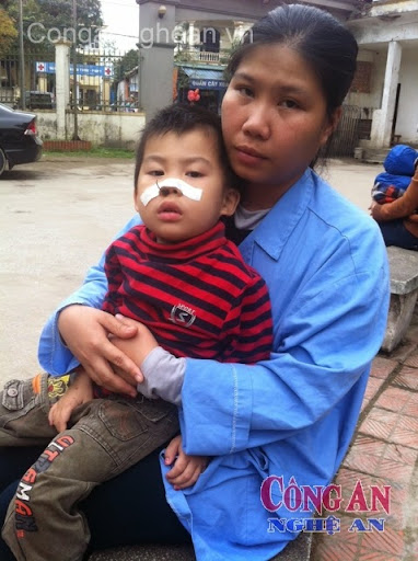 Cháu Bảo Đan yếu ớt bên vòng tay của mẹ tại Bệnh viện Sản - Nhi Nghệ An