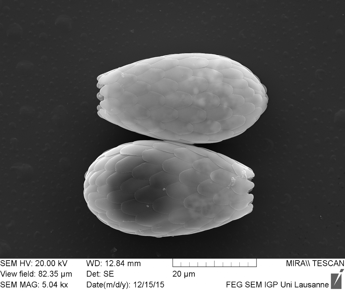 Immense species richness of bacterial-eating microorganisms discovered in soil Immense species richness of bacterial-eating microorganisms discovered in soil