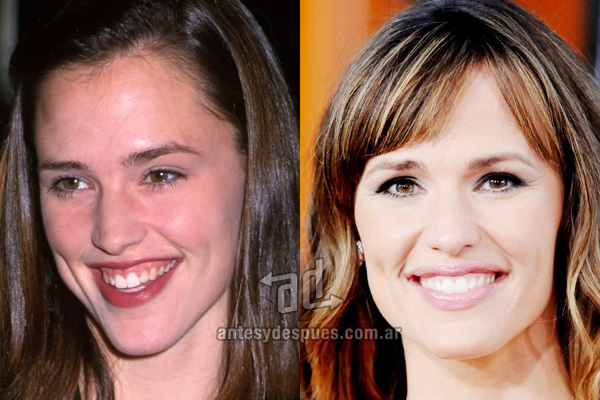 » 20 Best Celebrity Teeth | Before and After | Photos, Biography and Family