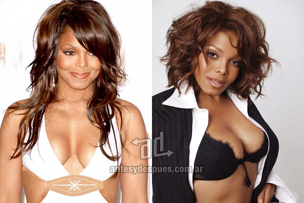 Los pechos operados de Janet Jackson