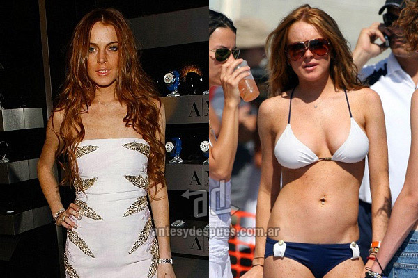 Los pechos operados de Lindsay Lohan
