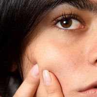 Post image for Why Getting Rid Of Acne The Easy Way Will Fail