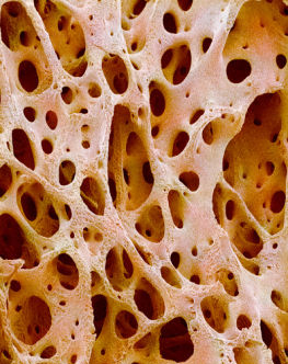 P1050176 Bone tissue SPL Foto foto hasil scanning mikroskop elektron