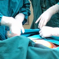 Post image for After Laparoscopic Surgery: What You Can Expect