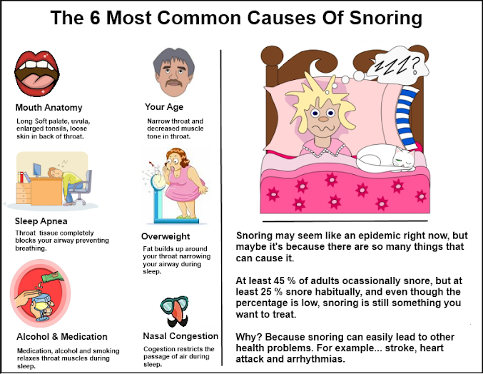 6 Most Common Causes of snoring