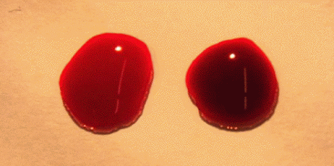 ¿Por qué la sangre es de color rojo?
