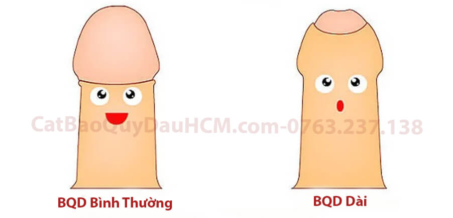 Hình ảnh bao quy đầu bị dài và bao quy đầu bình thường