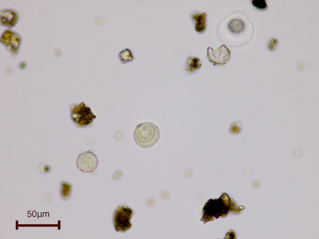 スギ花粉 むしめがねのちょっといいやつ 顕微鏡生活