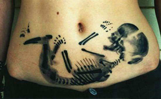 Aborto tatuado