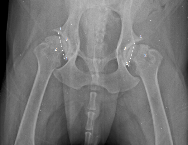 X-ray of a hip bone

Description automatically generated