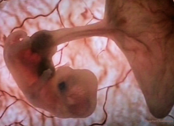Embryo 30 dagen