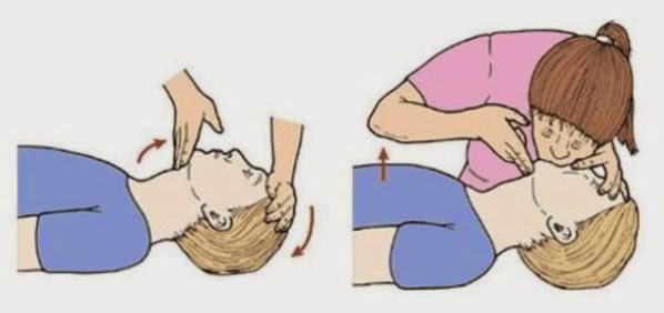 Airway