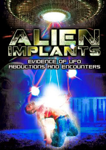 Alien Implants