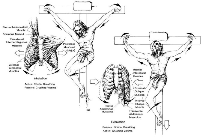 Suffocation Bergeron On Crucifixion