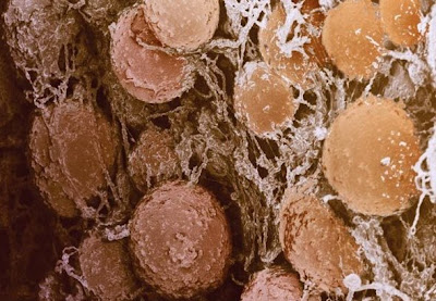 lemak Foto foto hasil scanning mikroskop elektron