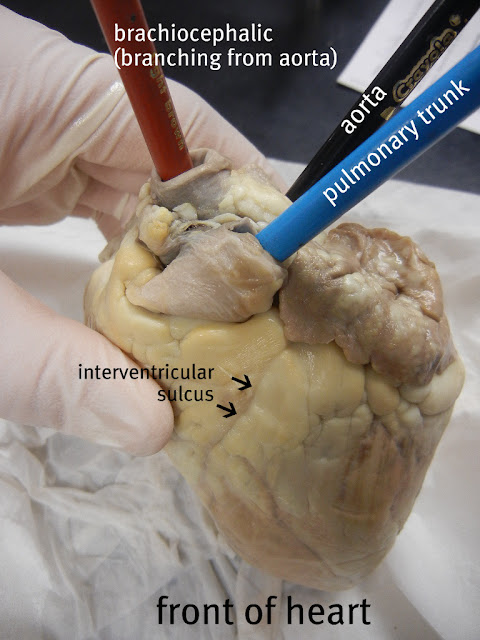 pulmonary trunk