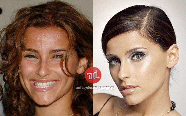 Photos of Nelly Furtado with acne