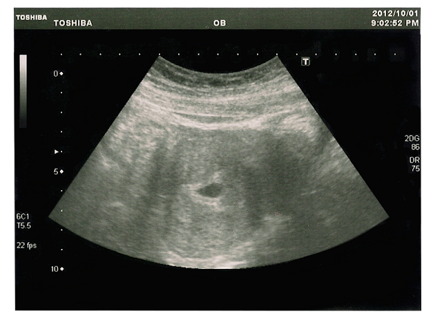 2012.10.01 湯圓的胚囊