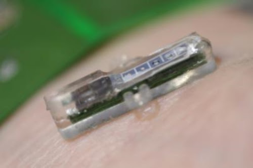 Implant wireless cat un plasture