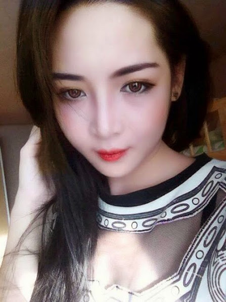 Cô gái Nam Định đẹp bất ngờ sau 3 tháng "dao kéo" - 6