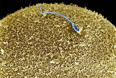 spermaovum Foto foto hasil scanning mikroskop elektron