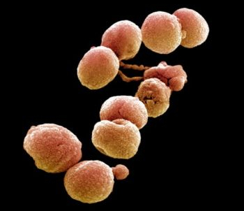 C0023196 Streptococcus pneumoniae bacteria%252C SEM SPL Foto foto hasil scanning mikroskop elektron