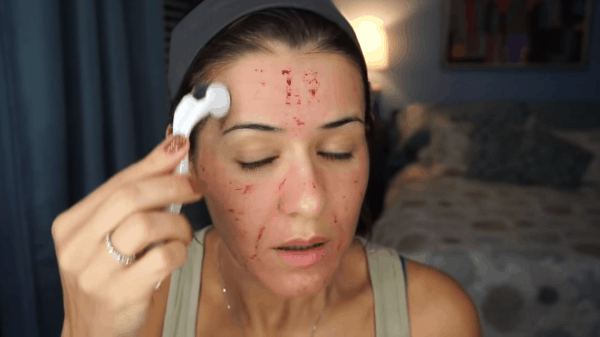 Hướng dẫn tự Lăn Kim tại nhà với tinh chất Collagen tươi Vieskin Hướng dẫn tự Lăn Kim tại nhà với tinh chất Collagen tươi Vieskin