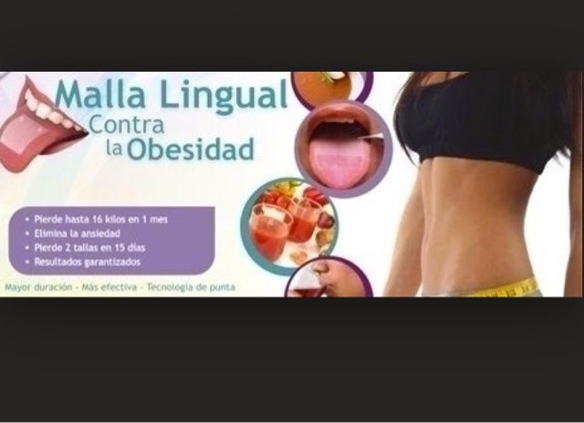 Malla lingual para bajar de peso en mexico Malla lingual para bajar de peso en mexico