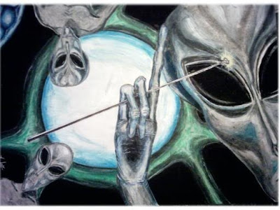 Doctors and nurses prepare for my colonoscopy