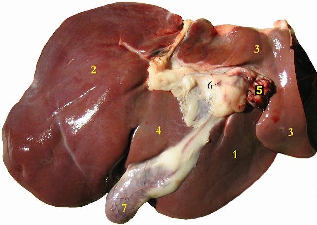 Teens arrested for plot to eat a woman's liver