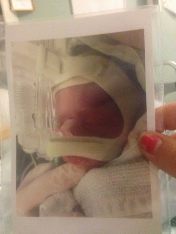 Koppla upp eller bryta upp serier photo 4