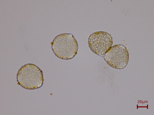 桜の花粉 むしめがねのちょっといいやつ 顕微鏡生活