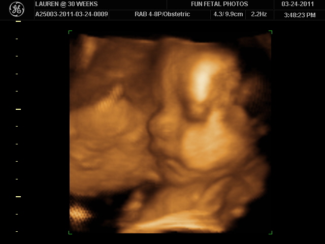 Мальчик 20 недель беременности. УЗИ двойни на 20 неделе беременности. 20 Недель беременности фото плода на УЗИ. Многоплодная беременность УЗИ 4д.