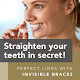 Ealing Dentist | Stunning Smile Clinic