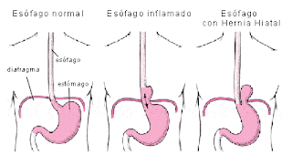 A mí 13 años pero a mí el pequeño pecho que hacer
