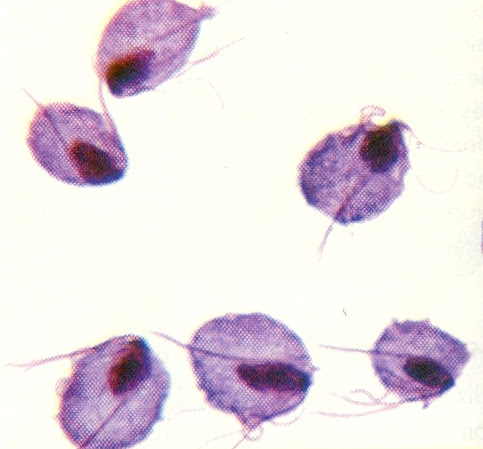 Inilah bentuk dari parasit protozoa Trichomonas vaginalis