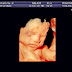 Mimi Baby Bump - 26 weeks pregnant 4D Ultrasound