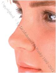 ideal nose ideal nose