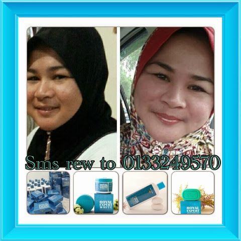 Testimoni royal expert white, produk penjagaan muka terbaik Testimoni royal expert white, produk penjagaan muka terbaik
