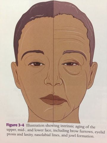 การหย่อนคล้อยของผิว aging skin, sagging face,Filler, ฟิลเลอร์,คอลลาเจน,หย่อนคล้อย