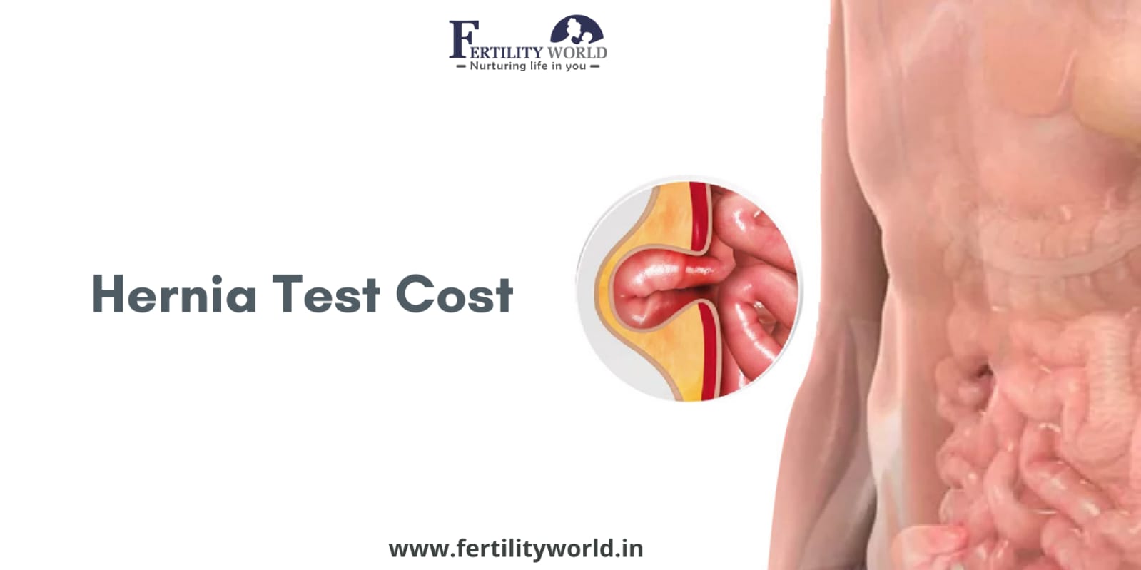 Cost of a hernia diagnostic test