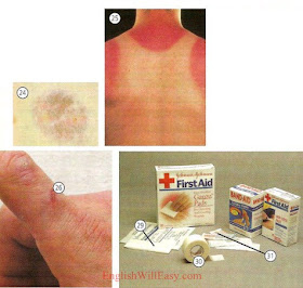 24. bruise 25. sunburn 26. cut 29. gauze (pad) 30.adhesive tape 31. adhesive bandage/ Band-Aid Minor ailments, remedies at the pharmacy - Health - Photo Dictionary Online
