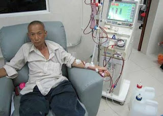 catatan shue kaedah rawatan hemodialisis dan capd catatan shue kaedah rawatan hemodialisis dan capd