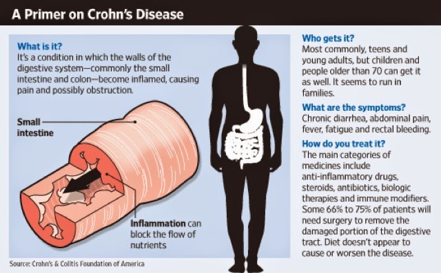 the causes and main features of crohns disease the causes and main features of crohns disease