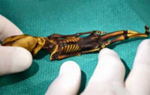Tiny Alien Body Recovered Shows Dna Not Human