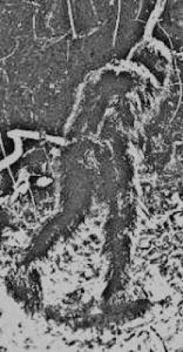 British Swiss Scientists Initiate Bigfoot Dna Study