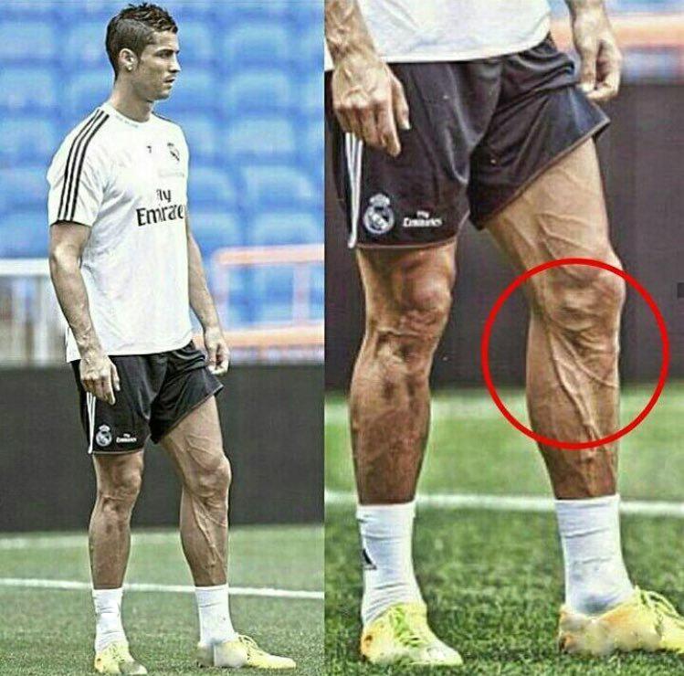 
Trên thế giới có lẽ không có cầu thủ nào sút nhiều như Cristiano Ronaldo. Đôi chân anh trở nên săn chắc và nổi đầy gân như một “quái thú”.