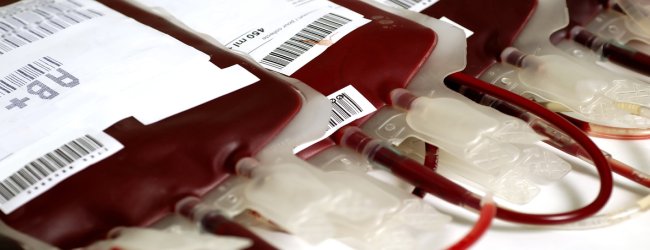 HEMATIES SANGRE hematies sangre: